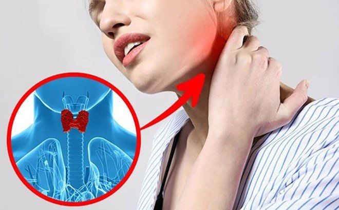 người có vấn đề về tuyến giáp không nên ăn đậu phụ